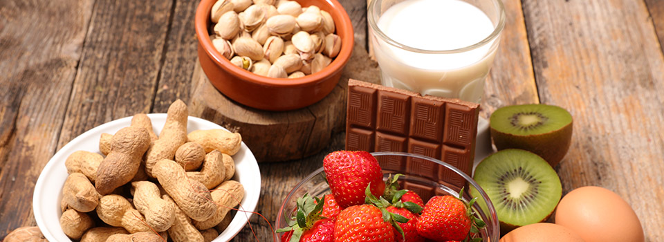 Unterschiedliche Lebensmittel können eine Kreuzallergien auslösen. Auf einem Tisch liegen Lebensmittel, zum Beispiel Schokolade, Nüsse, Kiwi, Erdbeeren, Eier und Milch.